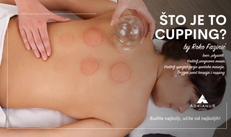 Što je to cupping?