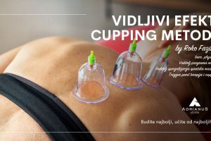 Cupping-header