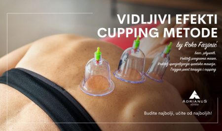Vidljivi fiziološki efekti cupping metode